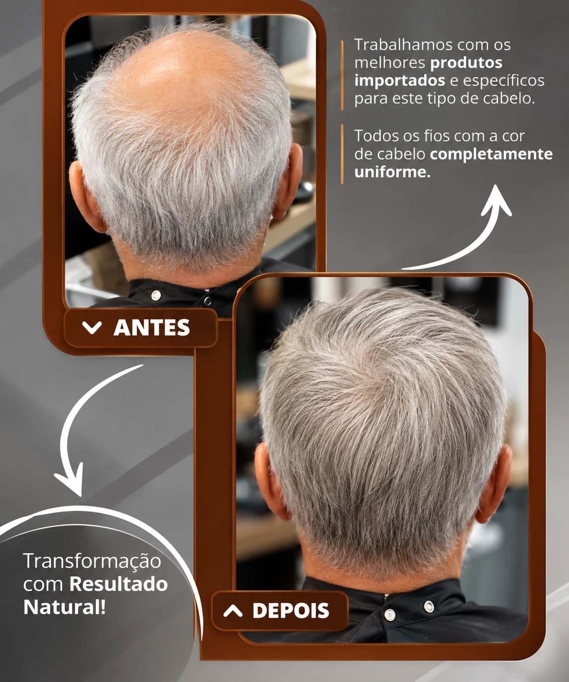 Antes e depois de prótese capilar com fios grisalhos